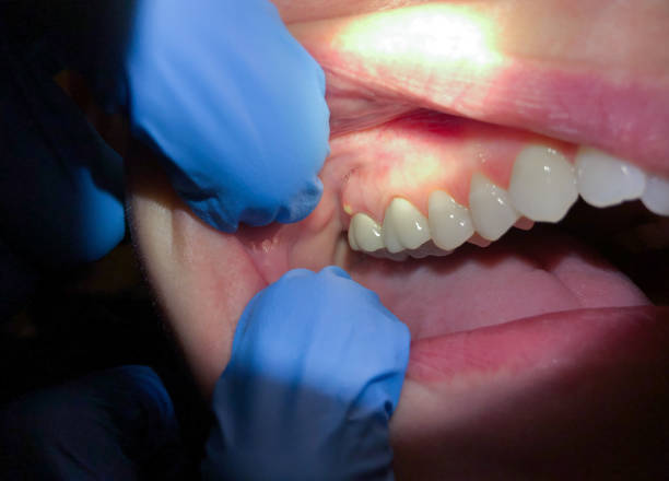 Best Emergency Dental Services for Seniors in Victoria, KS